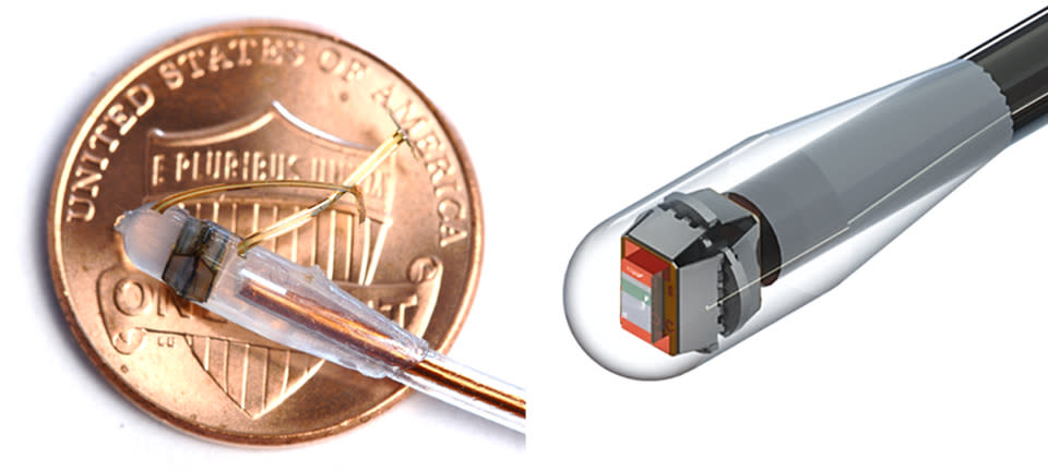 The pop-up sensor in a catheter