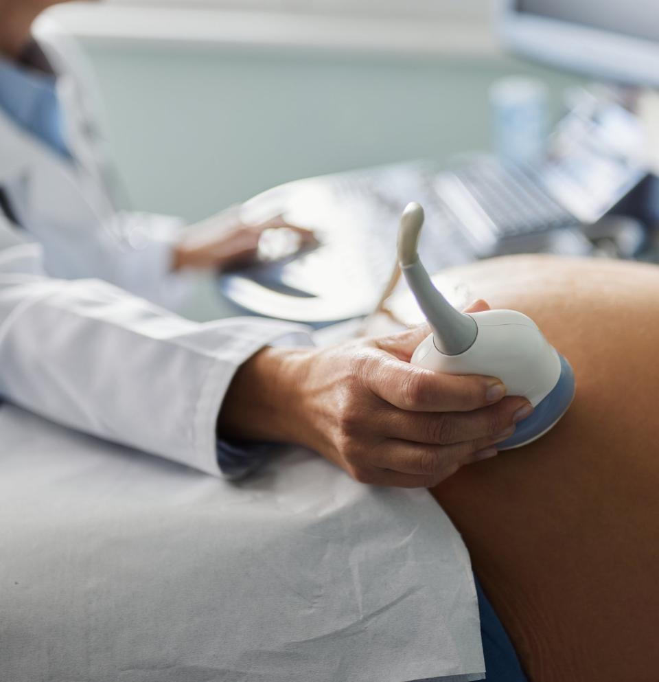 A woman having an ultrasound