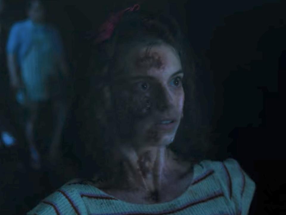 a woman with what appear to be fleshy wounds on her face looking forward in stranger things