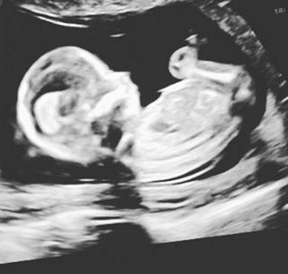 Elle shared a picture of the ultrasound. Photo: Instagram.