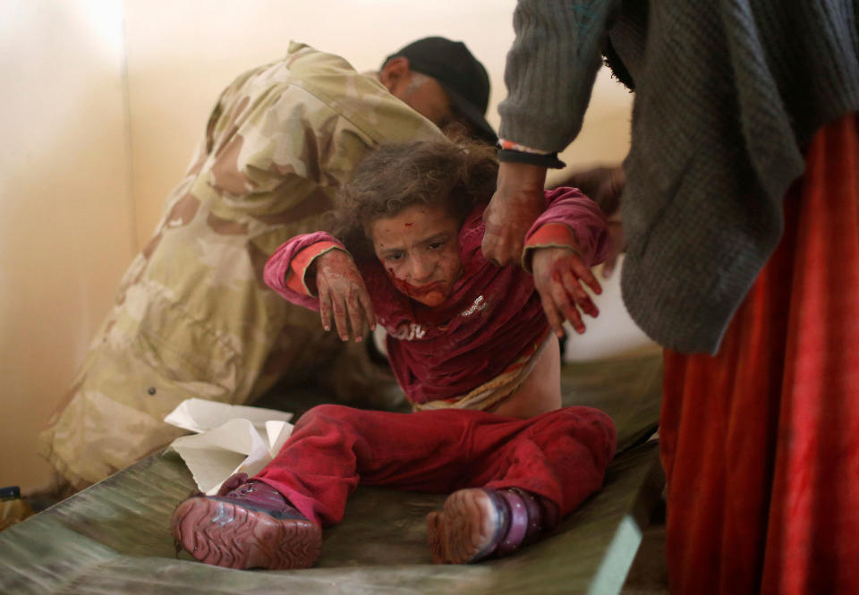 Wounded in Mosul