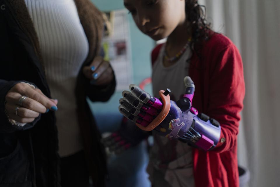 Mia Rodriguez holds a pen with one of her prosthetic hands made by the Manos de Héroes foundation in Salinas, Uruguay, Friday, April 14, 2023. Mia, whose fingers did not fully develop, chose violet with pink prosthetic hands to match her unicorn stickers. (AP Photo/Matilde Campodonico)