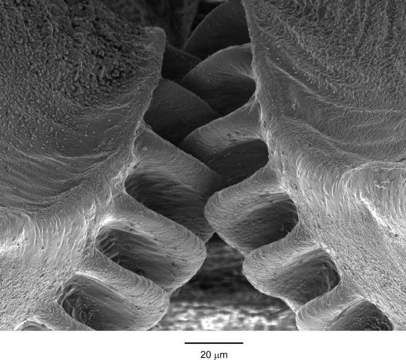 The intermeshing gears on the hind legs of a planthopper insect are shown in this scanning electron micrograph image.