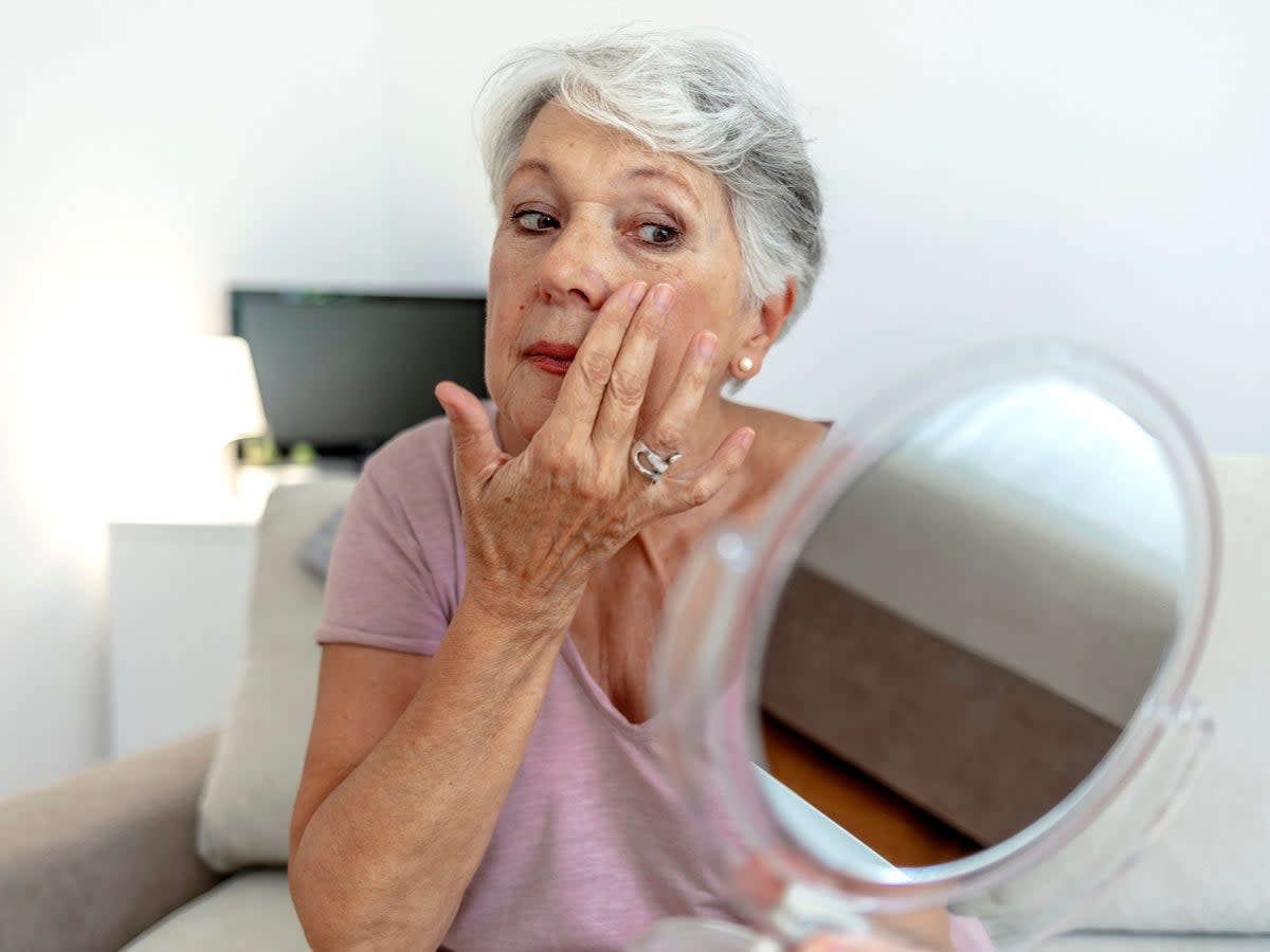 La ictericia, el color amarillento de los ojos y la piel, se considera un síntoma de 'bandera roja' del cáncer de páncreas. (Getty Images/iStockphoto)