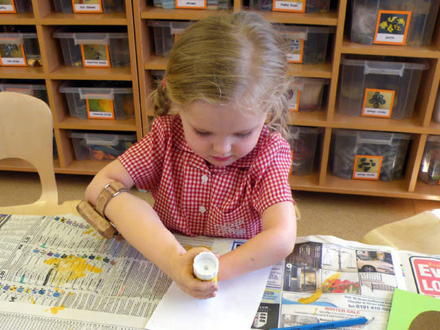 Tilly Lockey, pictured aged three, at nursery using an electronic arm in 2008. (Lockey family/SWNS)