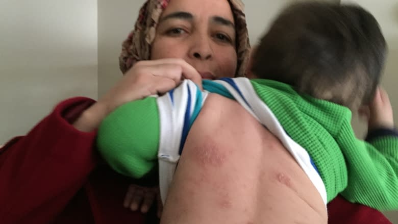 Syrian refugee family combats bedbugs in Halifax apartment