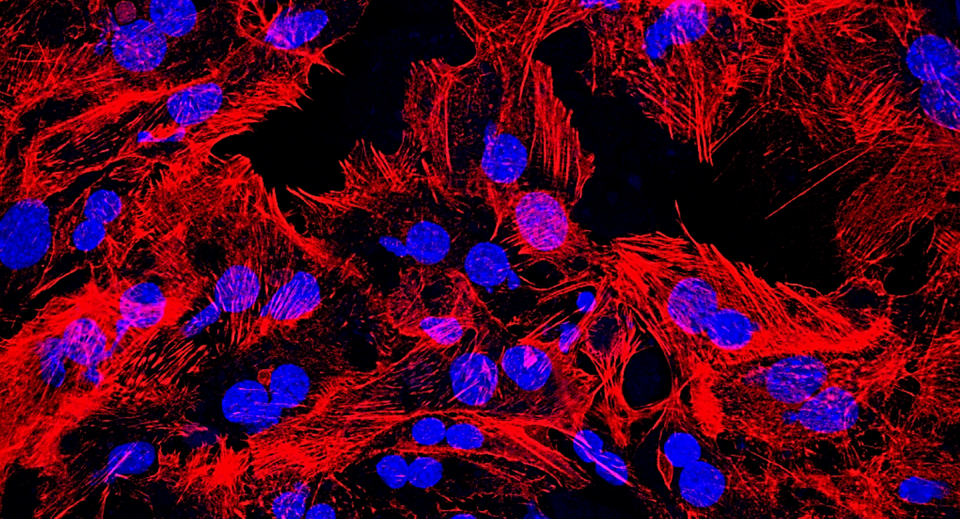 <span class="caption">Hepatocitos marcados con sondas fluoresecentes</span>