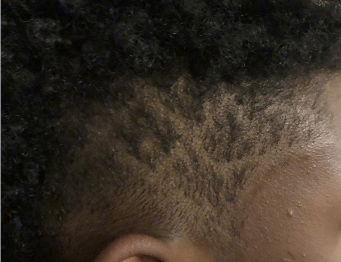 A school district has apologized to a mother for punishing her son for his “distracting hairstyle.” (Photo: Erika Paggett/ACLU)