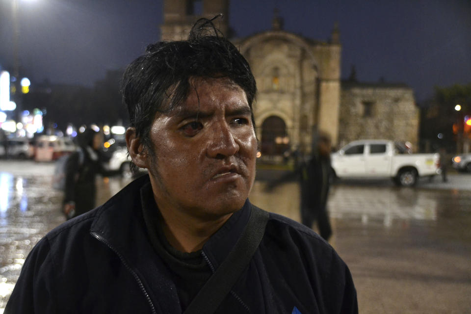 Alex Mamani, de 34 años, posa para una fotografía en la plaza principal de Juliaca, región de Puno, Perú, el viernes 1 de diciembre de 2023. Mamani recibió un disparo en la mandíbula en enero de 2023 durante las protestas que exigían la renuncia de la presidenta Dina Boluarte. (AP Foto/Franklin Briceño)