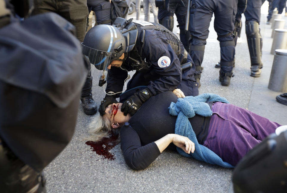 EDS NOTE: GRAPHIC CONTENT. FILE - In this Saturday, March 23, 2019 file picture, a police officer inspects anti-globalization activist Genevieve Legay, 73, as she lies unconscious after collapsing on the ground during a protest in Nice, southeastern France, as part of the 19th round of the yellow vests movement. Genevieve Legay was waving a rainbow flag marked "Peace" and a yellow vest when riot police carrying shields suddenly pushed toward the group of a few dozen protesters Saturday. (AP Photo/Claude Paris, File)