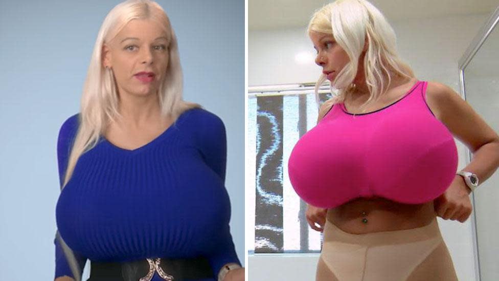 Woman who claims to have 'biggest breasts in Europe' reveals what she  looked like before having plastic surgery