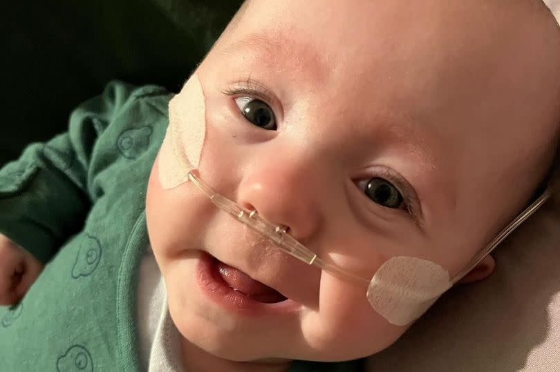 Baby Jude is battling a chronic lung disease