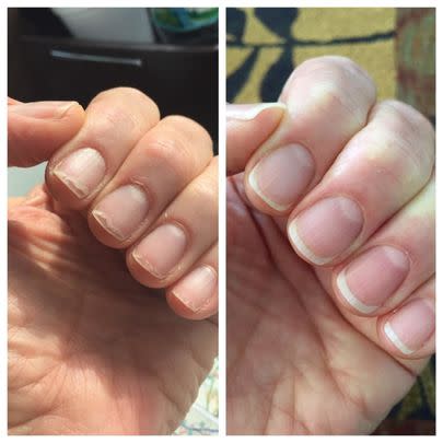 A cuticle oil because too many gel manis have destroyed your nails