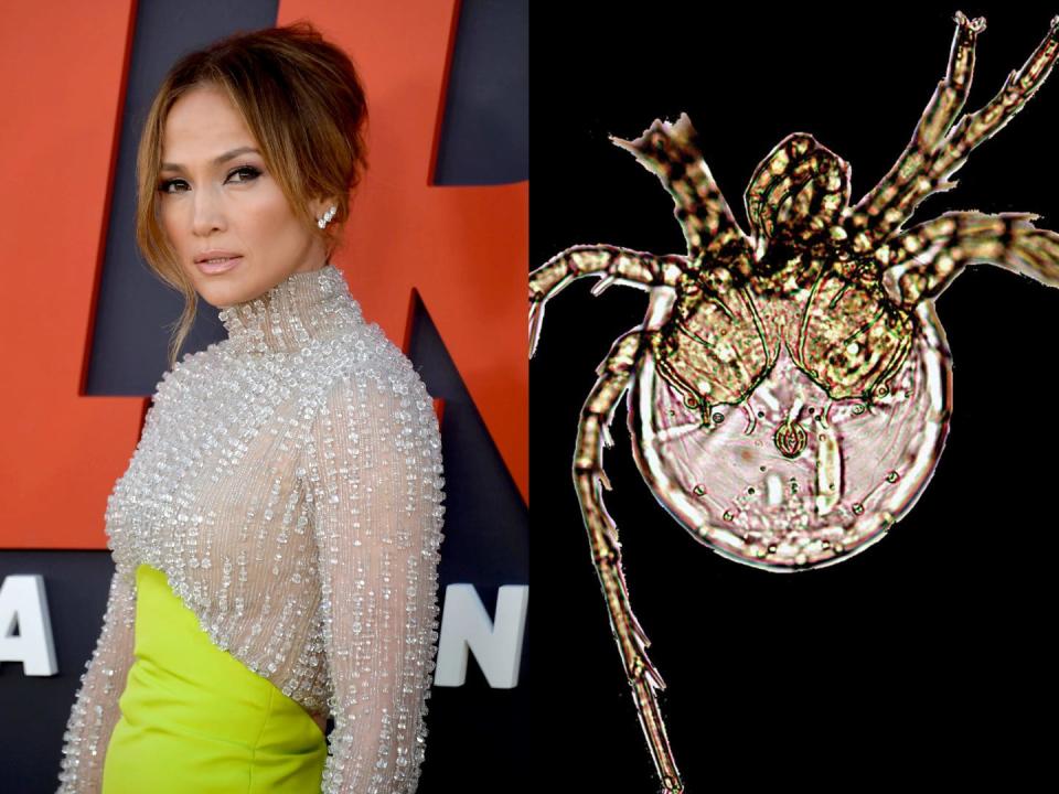 A side-by-side image of Jennifer Lopez on a red carpet and the Litarachna lopezae mite on black background.