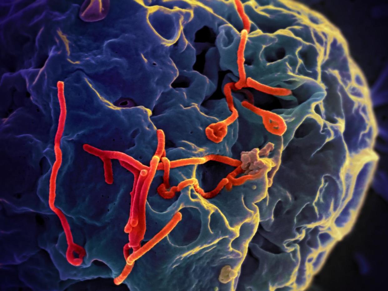 <span class="caption">This image shows Ebola virus particles (red) budding from the surface of kidney cell (blue).</span> <span class="attribution"><a class="link " href="https://flic.kr/p/oq68Cn" rel="nofollow noopener" target="_blank" data-ylk="slk:National Institute of Allergy and Infectious Diseases/Flickr;elm:context_link;itc:0;sec:content-canvas">National Institute of Allergy and Infectious Diseases/Flickr</a>, <a class="link " href="http://creativecommons.org/licenses/by-sa/4.0/" rel="nofollow noopener" target="_blank" data-ylk="slk:CC BY-SA;elm:context_link;itc:0;sec:content-canvas">CC BY-SA</a></span>