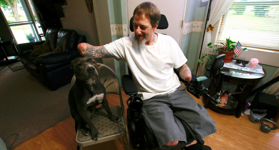 Greg Manteufel and Ellie, after a dog germ nearly caused the Wisconsin man's death.