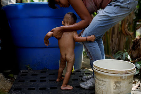 Maria Guitia washes her son Yeibe Medina at home near San Francisco de Yare, Venezuela, February 18, 2019. REUTERS/Carlos Garcia Rawlins