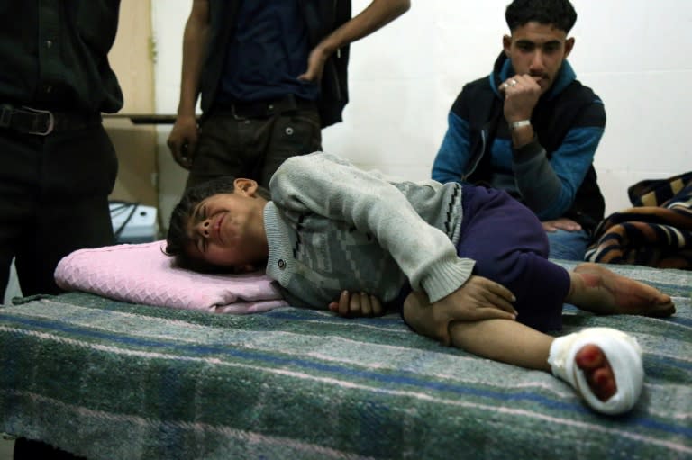 A wounded child on a bed at a makeshift hospital in the Eastern Ghouta town of Kafr Batna on November 18, 2017