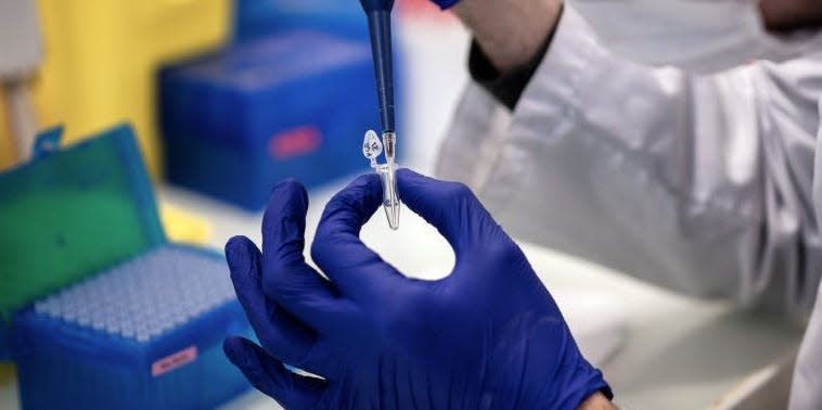 A scientist works on Covid-19 samples to find variations of the virus, at the Croix-Rousse hospital laboratory in Lyon, central eastern France, on January 14, 2021.