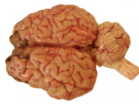 Human Brain