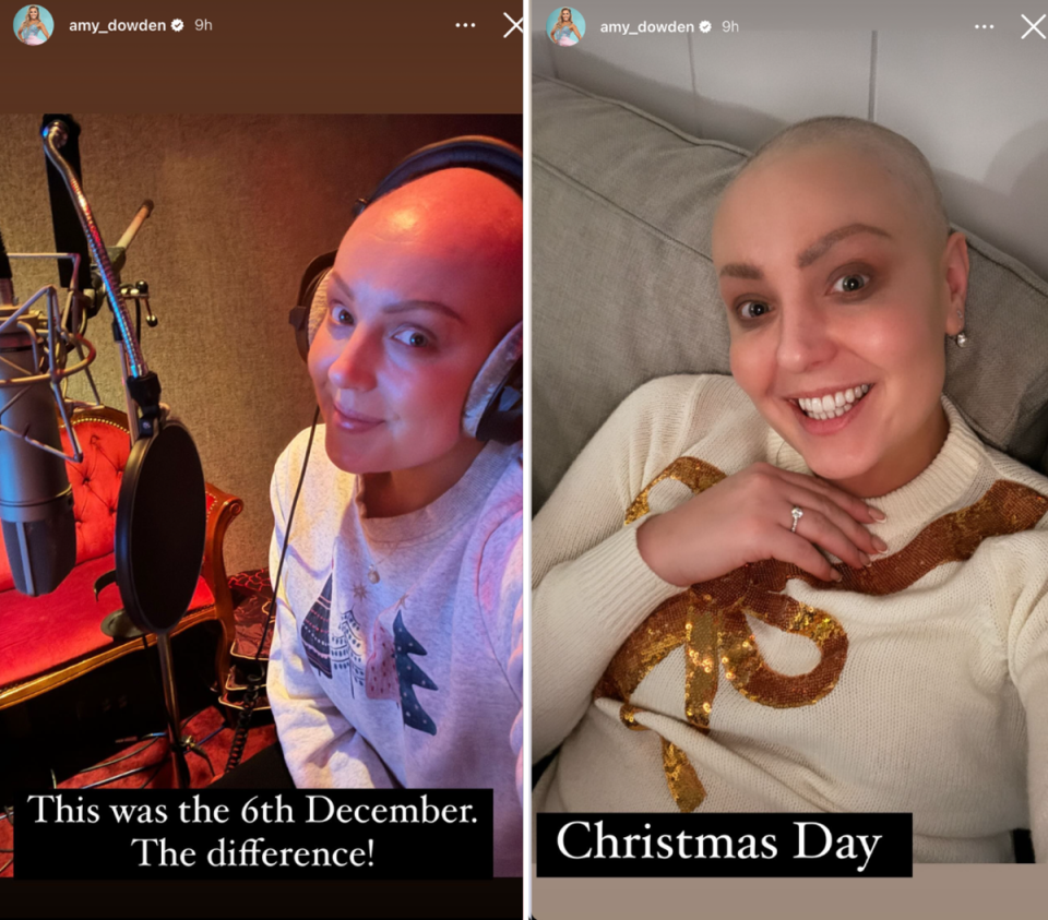 Dowden revealed the hair she had lost through chemotherapy has started growing back (Amy Dowden)