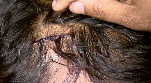 The restaurant was glassed on the head, leaving a nasty gash. Source: 7 News