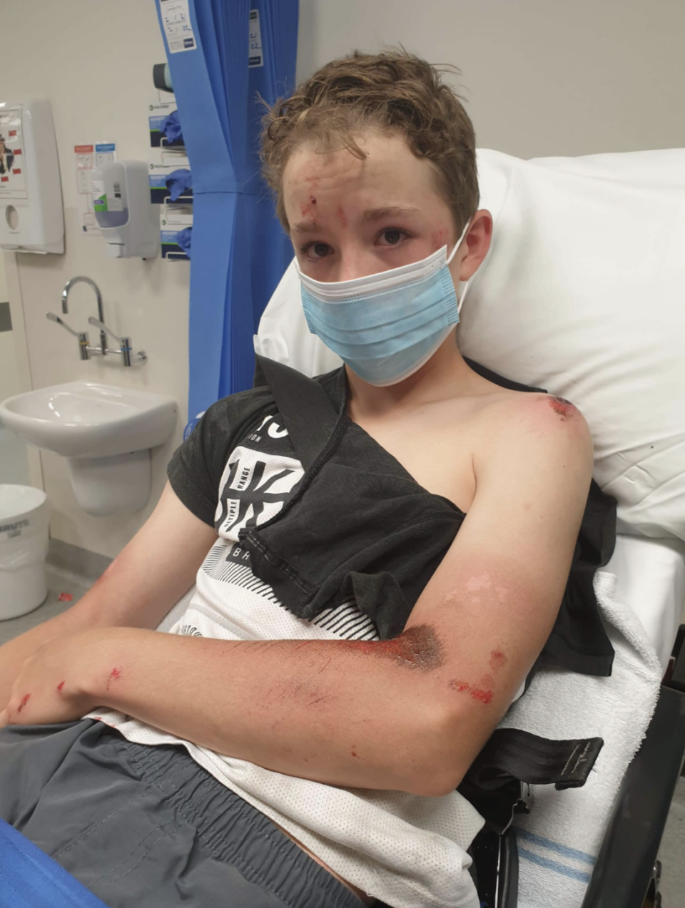 A 12-year-old boy who broke his arm after falling off his bike.