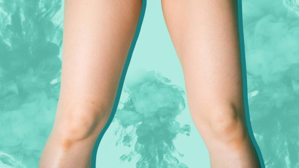 A Vaginal Steam Treatment Gave This Woman A Second Degree Burn On Her Vagina