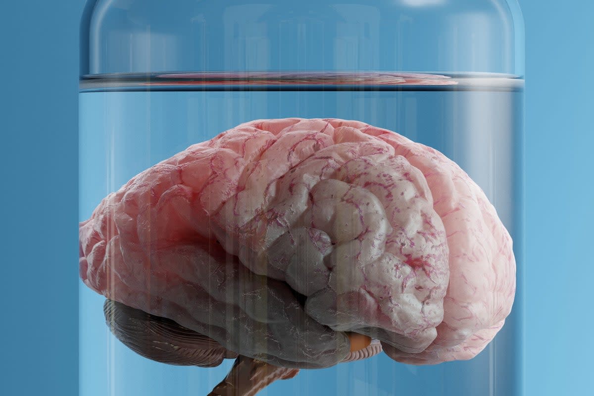 New invention uses algorithm to maintain the necessary blood flow, pressure and oxygenation to allow a severed brain to keep functioning (iStock/ Getty Images)