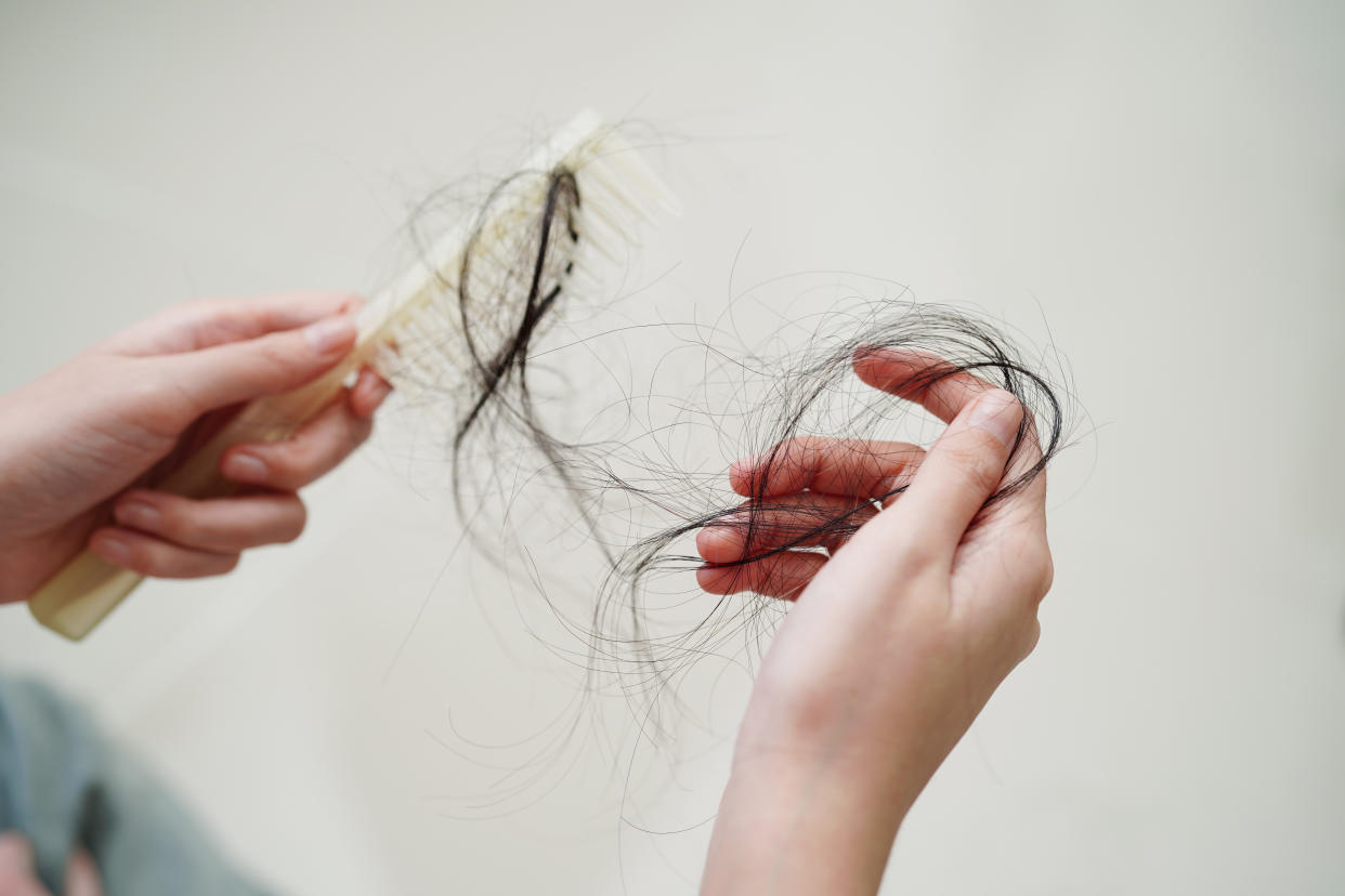 How much hair loss is normal — and when should you be concerned? (Getty Creative)