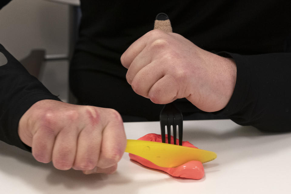 Joe DiMeo uses his new hands to grasp a knife and fork to cut some modeling plastic during an occupational therapy session, Jan. 25, 2021 in New York. DiMeo has been in intensive rehabilitation, devoting hours daily to physical, occupational and speech therapy. (AP Photo/Mark Lennihan)