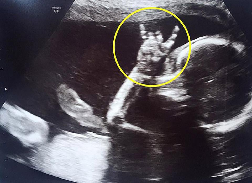 rock music baby ultrasound sign horns Badass baby flashes rockin Sign of the Horns during ultrasound