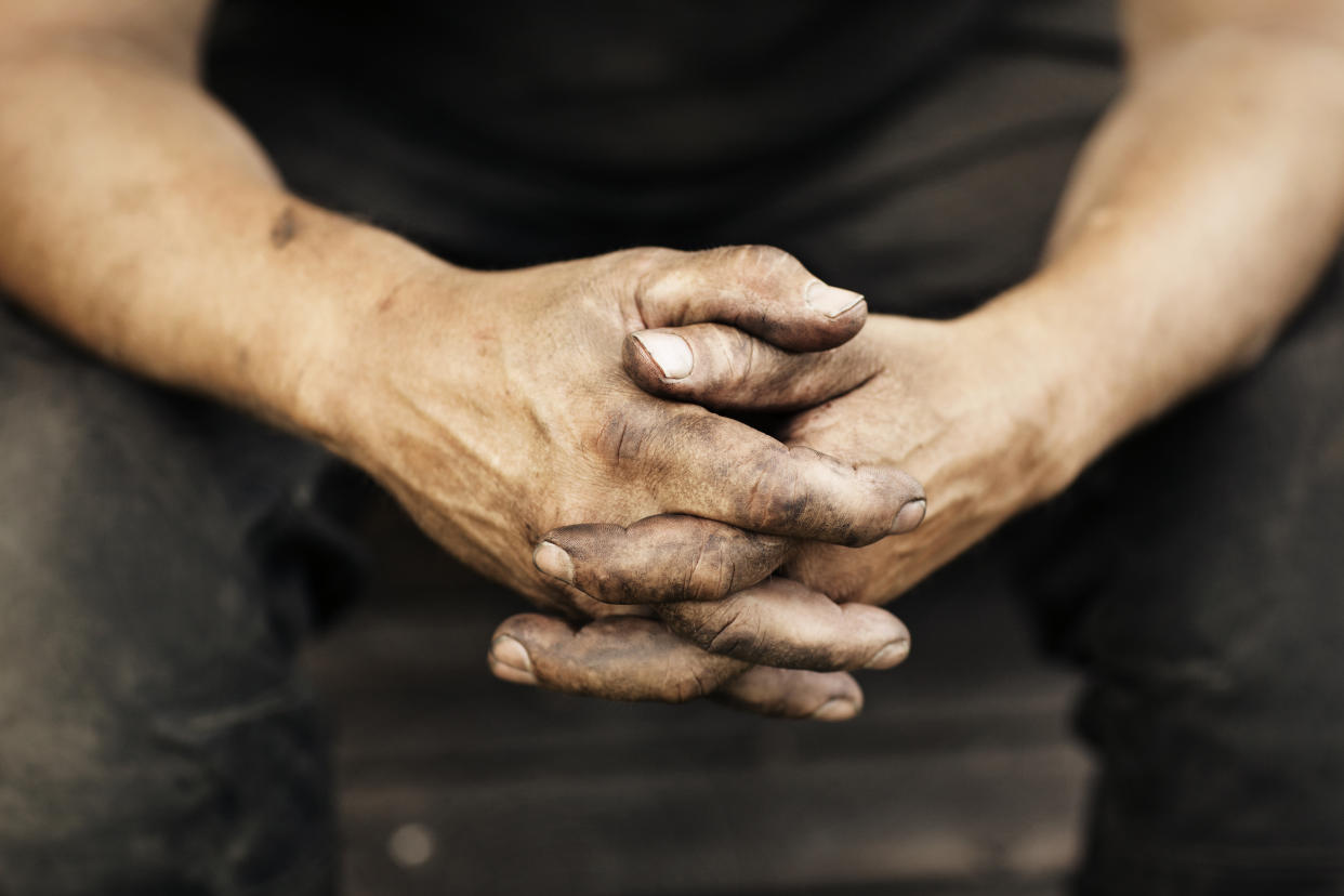 Exponemos a nuestras manos a condiciones extremas que pueden deteriorar su estado. / Imagen: Getty Images