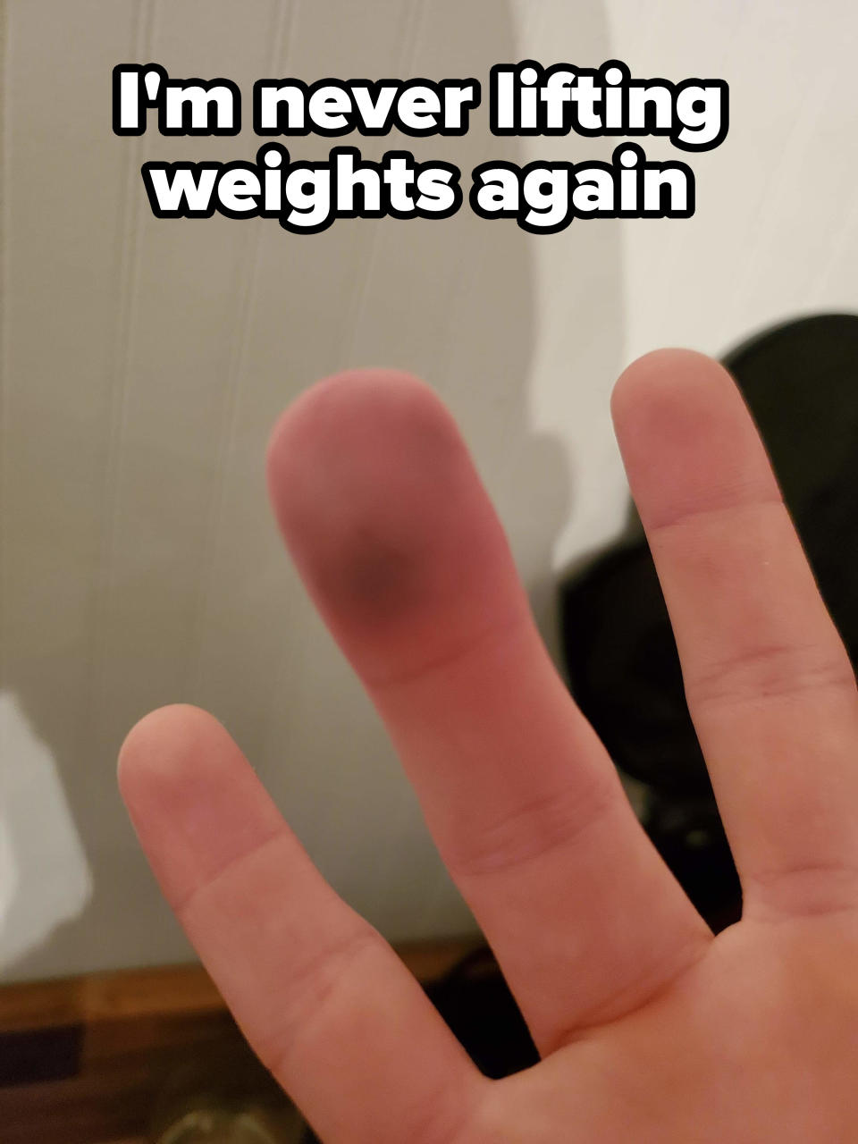 Someone's swollen finger