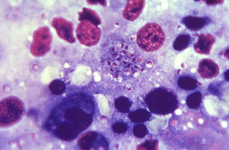 A liver tissue specimen containing several Histoplasma capsulatum fungal organisms.