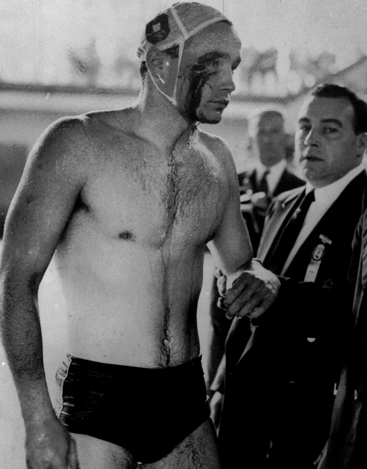 Blood streams from the cut eye of Hungarian Ervin Zador injured during a fight with a member of the Soviet team in the closing stages of the Hungary vs. USSR water polo match at the 1956 Olympic Games.