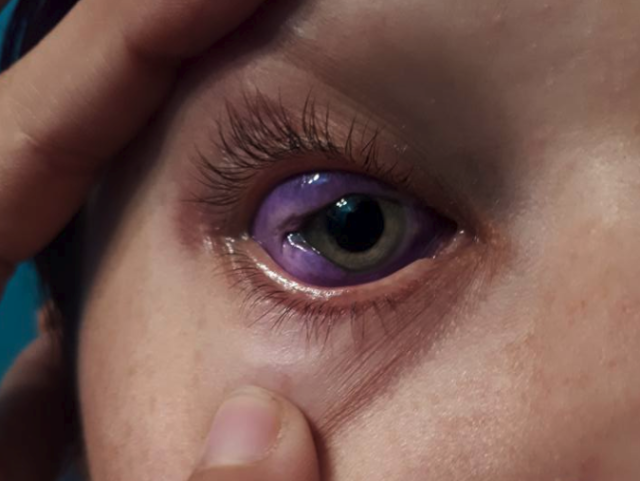 Thinking About Getting An Eyeball Tattoo? Read this First.