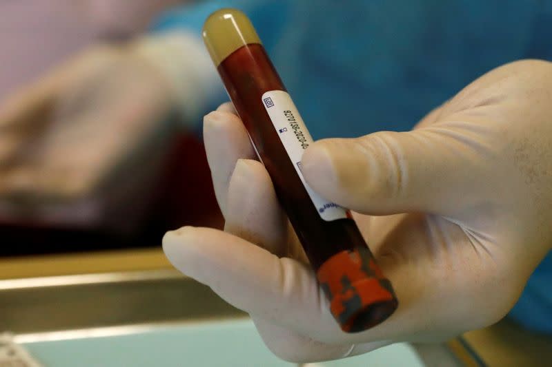 Dr. Vincent Carrao shows blood taken from a patient for the coronavirus disease (COVID-19) test at Palisades Oral Surgery, in Fort Lee