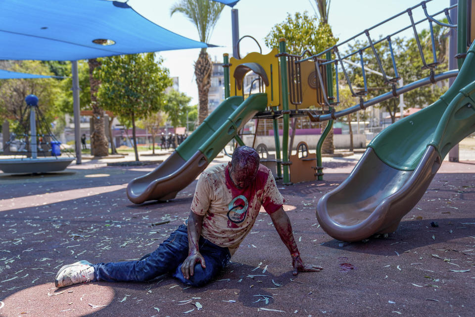 A supporter of the Eritrean government lies injured and covered in blood after he was hurt by an Anti-Eritrean government activist, during a protest against an event organized by the Eritrea Embassy in Tel Aviv, Israel, Saturday, Sept. 2, 2023. Hundreds of Eritrean asylum seekers smashed shop windows and police cars in Tel Aviv on Saturday and clashed with police during a protest against an event organized by the Eritrea Embassy. The Israeli police said 27 officers were injured in the clashes, and at least three protesters were shot when police opened fire with live rounds when they felt "real danger to their lives." (AP Photo/Ohad Zwigenberg)