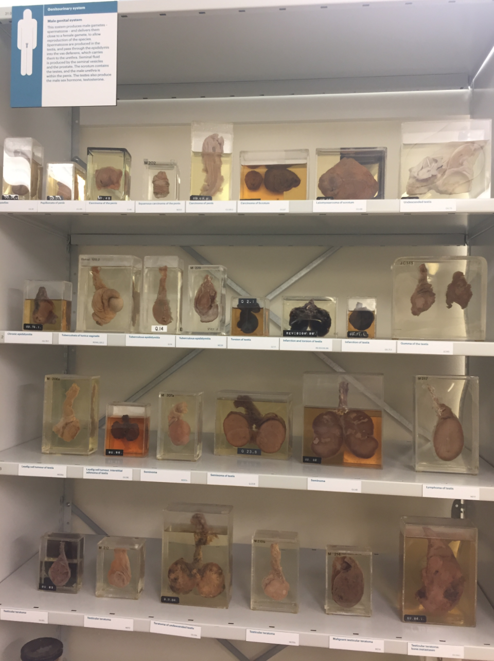 Muestras del sistema genital masculino en el museo de Patología de la UCL.