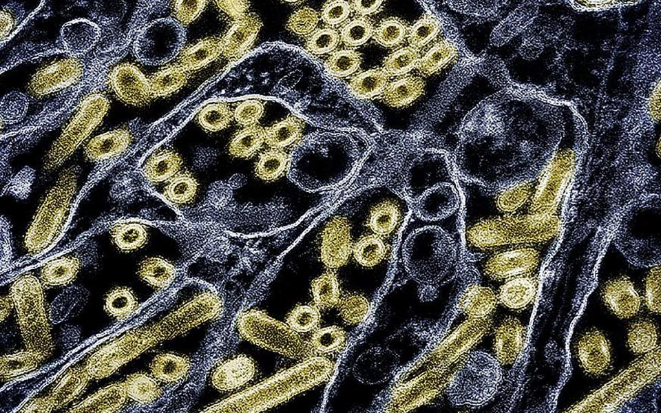 A colorised transmission electron micrograph of avian influenza A H5N1 virus particles