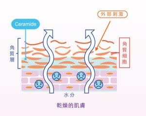圖二、乾燥的肌膚：神經醯胺不足，水份流失，抵抗力差。  （圖片提供／Donna營養師陳怡錞部落格）