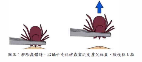 （圖片提供／亞東醫院）