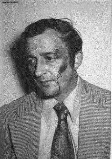 FBI Agent Delbert Hahn had an inflamed bruise on his left eye immediately after the confrontation on July 18, 1973, that led to Milton Scott’s death.