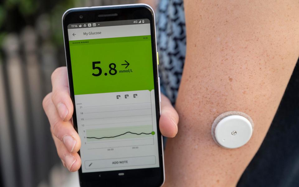 Glucose trackers can be worn on or under the skin to help patients see their blood sugar levels - Paul Grover