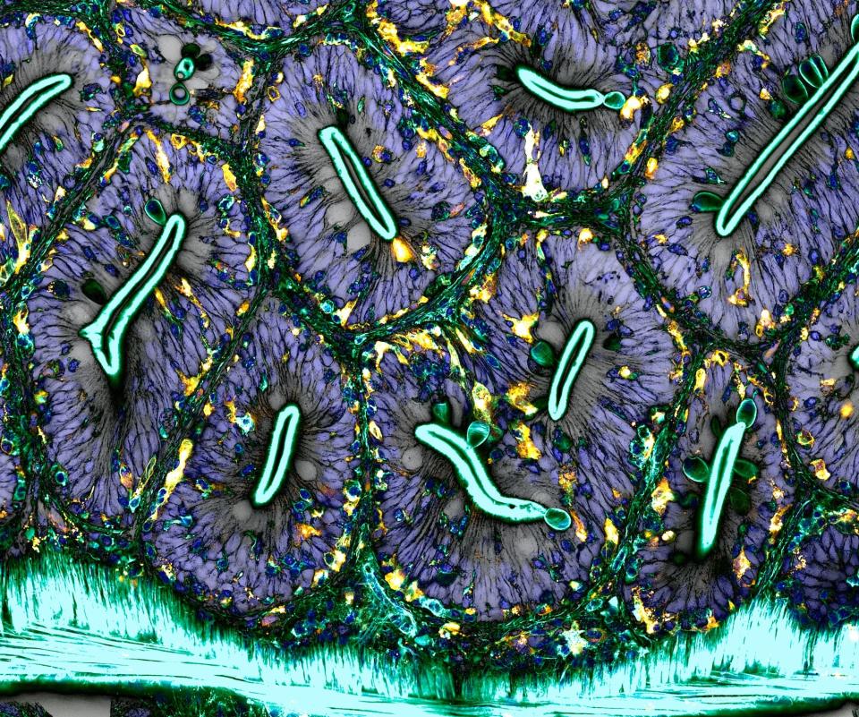 Network of macrophages (white blood cells) of an adult zebrafish intestine