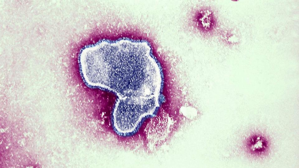 PHOTO: Thic Electron Micrograph Reveals The Morphologic Traits Of The Respiratory Syncytial Virus RSV. (Bsip/Universal Images Group via Getty Images)