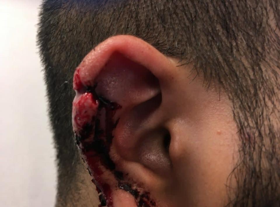 One of the victims was shot through the ear (MPS)