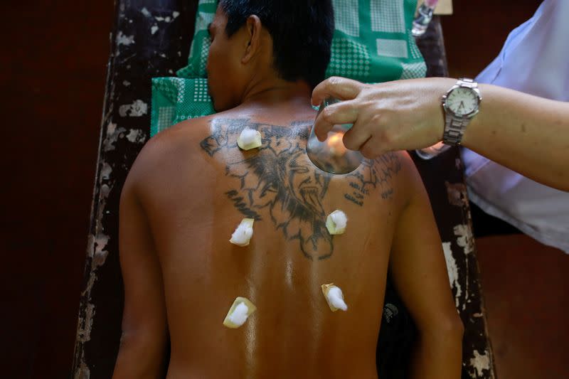 A drug rehab patient gets ventosa or cupping therapy to help ease withdrawals at a community drug rehabilitation facility in Caloocan