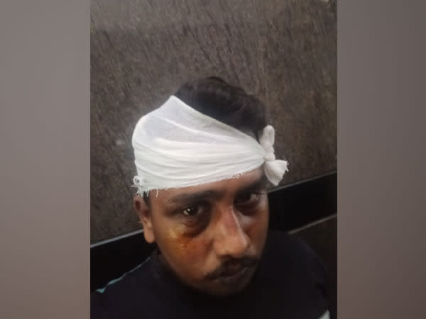 Delivery person Rahul Sharma alleged he was assaulted by six Shiv Sena workers (Photo/ANI)